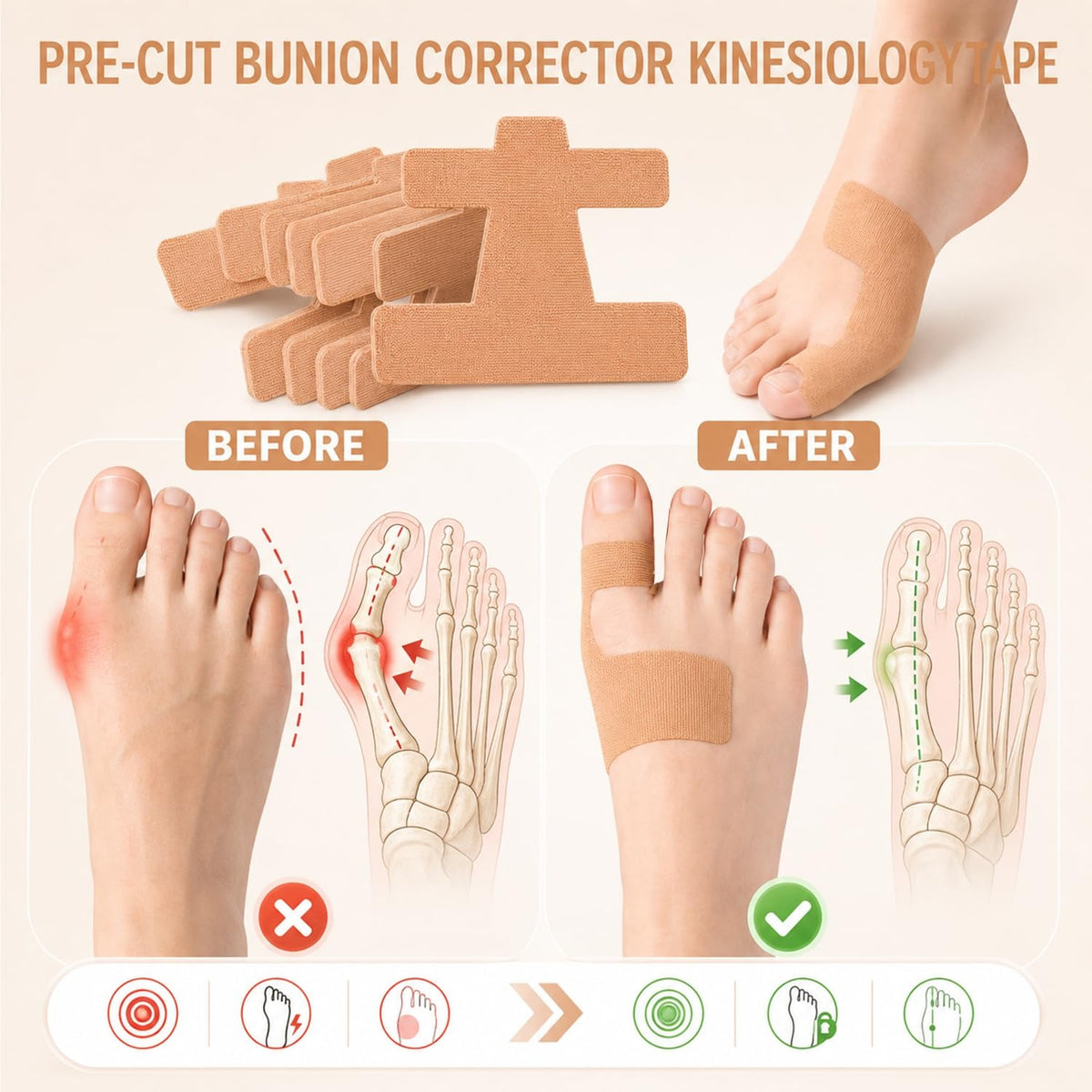 BuniFix Bunion Corrector Support Strips